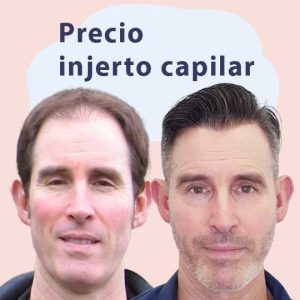 Precio-injerto-capilar