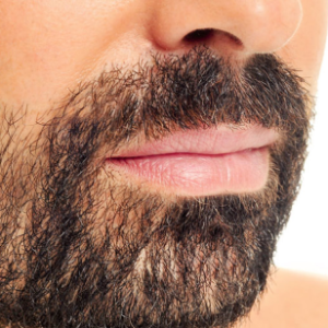 implante de barba